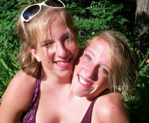 Conjoined twins Abby and Brittany Hensel dream of getting married